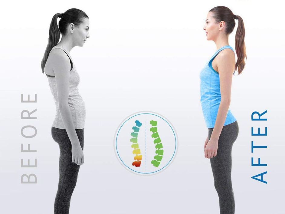 Posture Corrector — Adjustable Back & Spine Support Brace for Men & Women